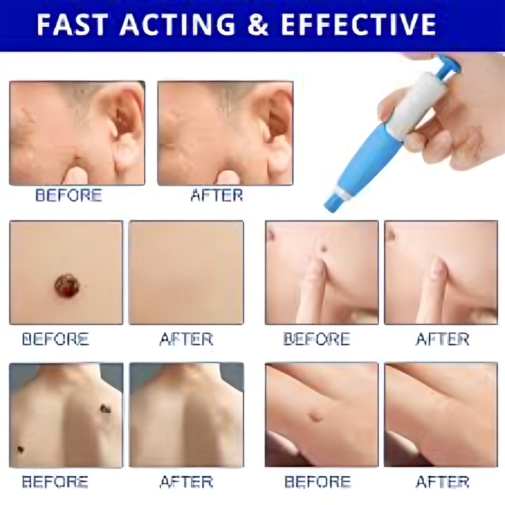 Tag Free Skin Solution