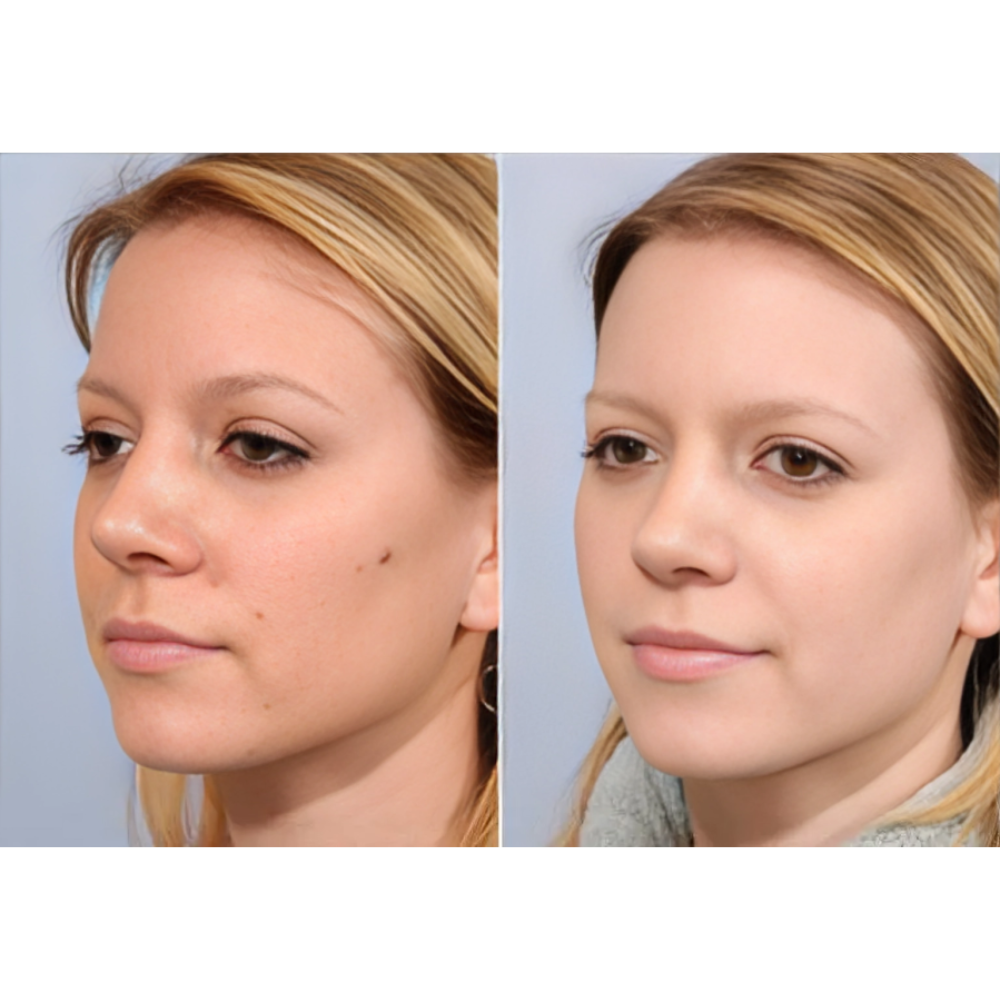 Tag Free Skin Solution